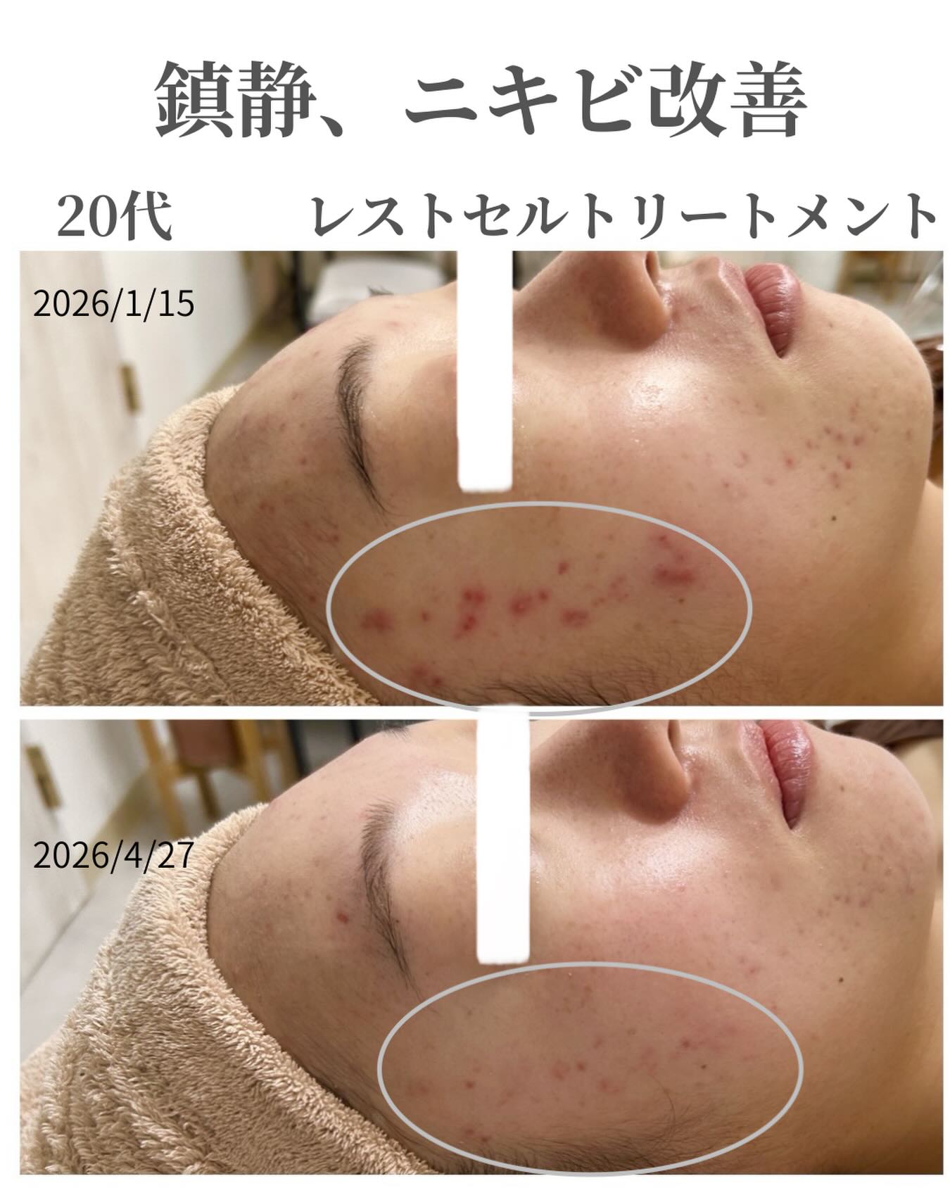 RE L'ABEAUTE（リアボーテ） 公式サイト 幹細胞サイエンスの最高峰の