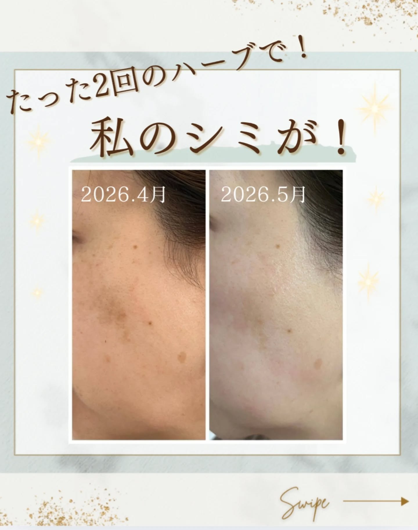 RE L'ABEAUTE（リアボーテ） 公式サイト 幹細胞サイエンスの最高峰の