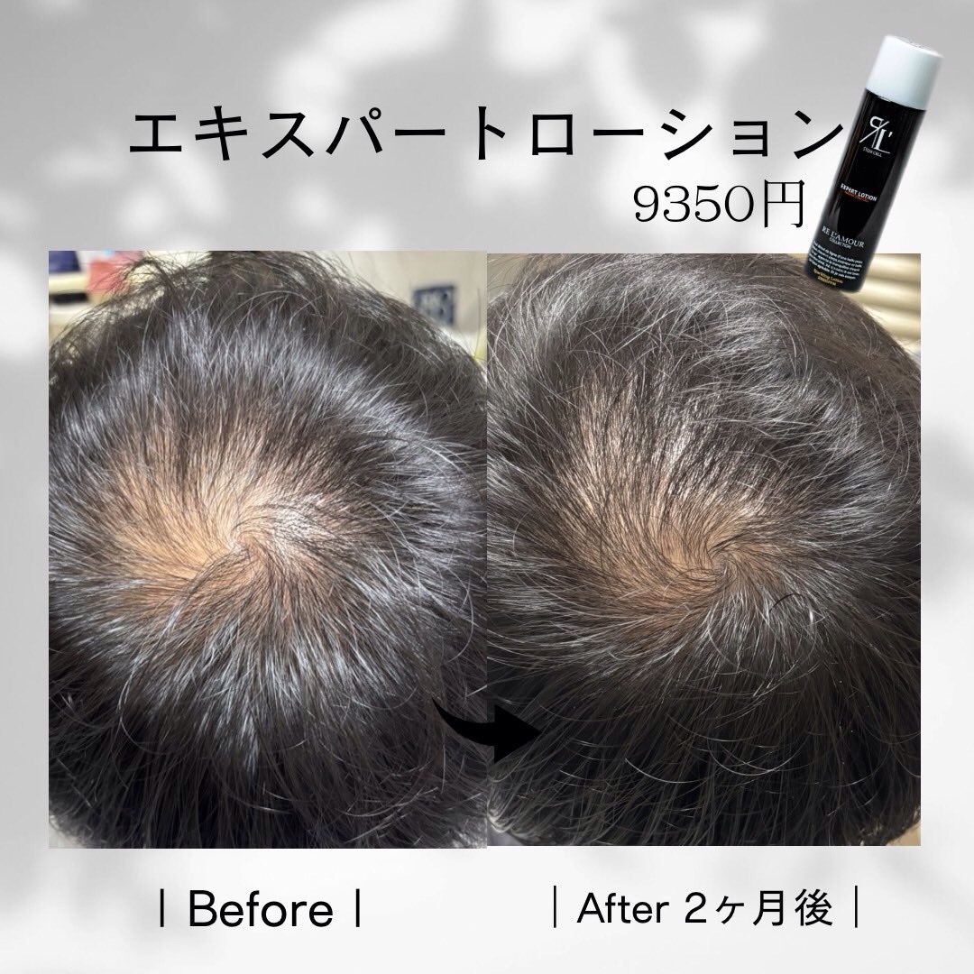 RE L'ABEAUTE（リアボーテ） 公式サイト 幹細胞サイエンスの最高峰の