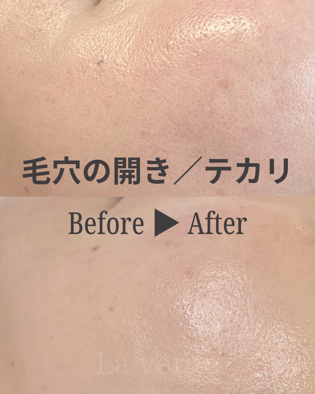 RE L'ABEAUTE（リアボーテ） 公式サイト 幹細胞サイエンスの最高峰の