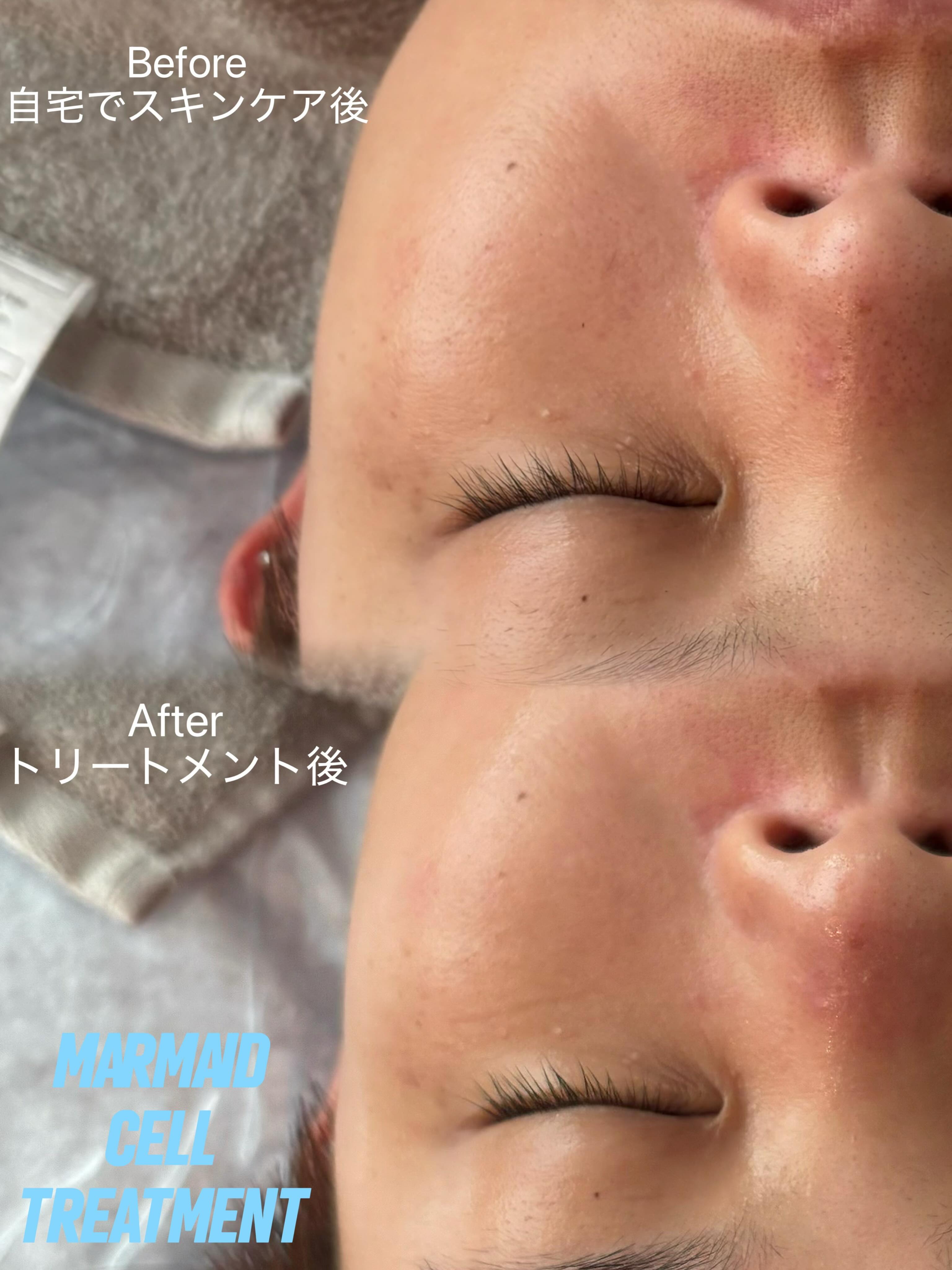 RE L'ABEAUTE（リアボーテ） 公式サイト 幹細胞サイエンスの最高峰の