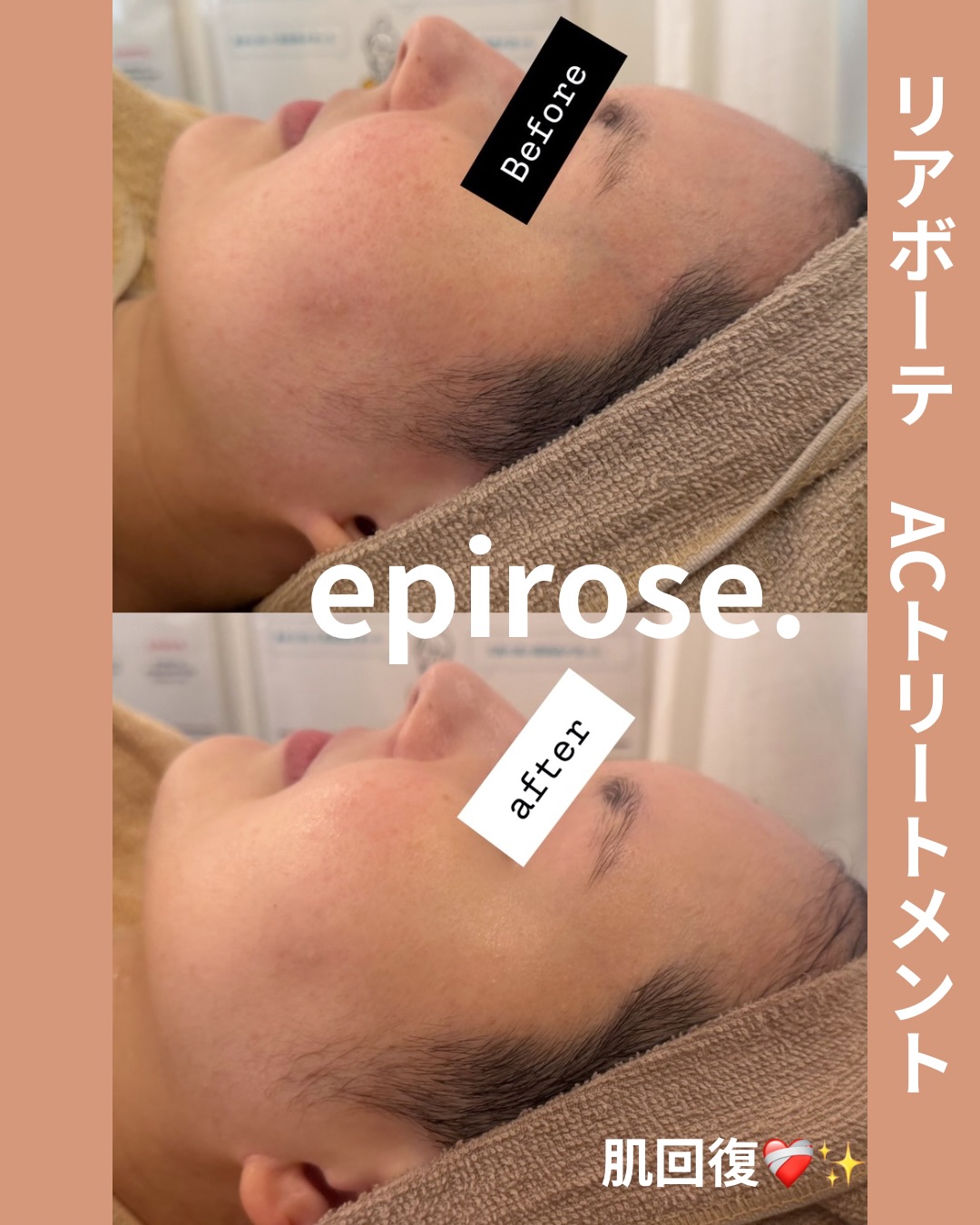 リアボーテ　美容器 正規品 RE L'ABEAUTE（リアボーテ） 公式サイト 幹細胞サイエンスの最高峰の