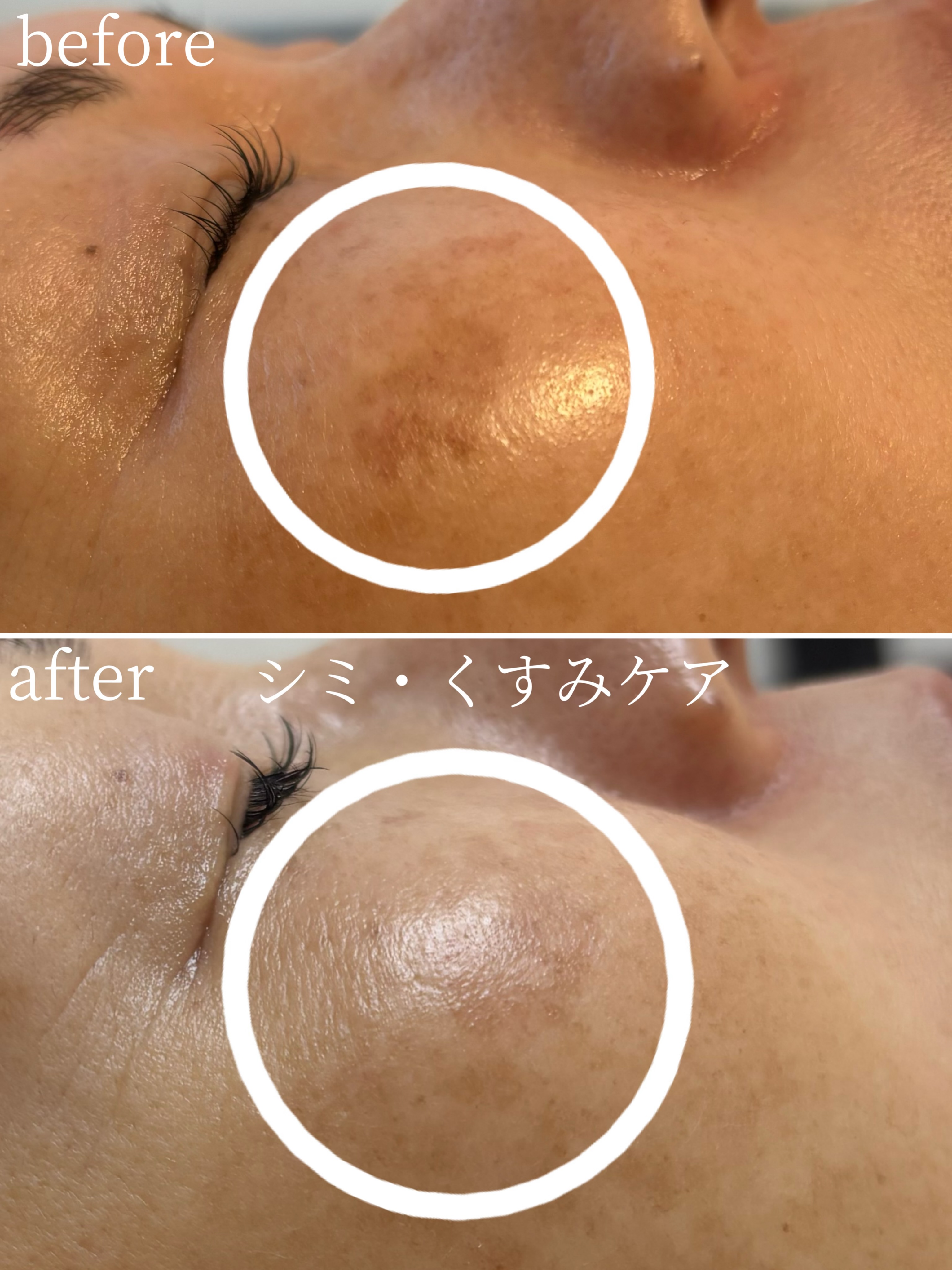 RE L'ABEAUTE（リアボーテ） 公式サイト 幹細胞サイエンスの最高峰の