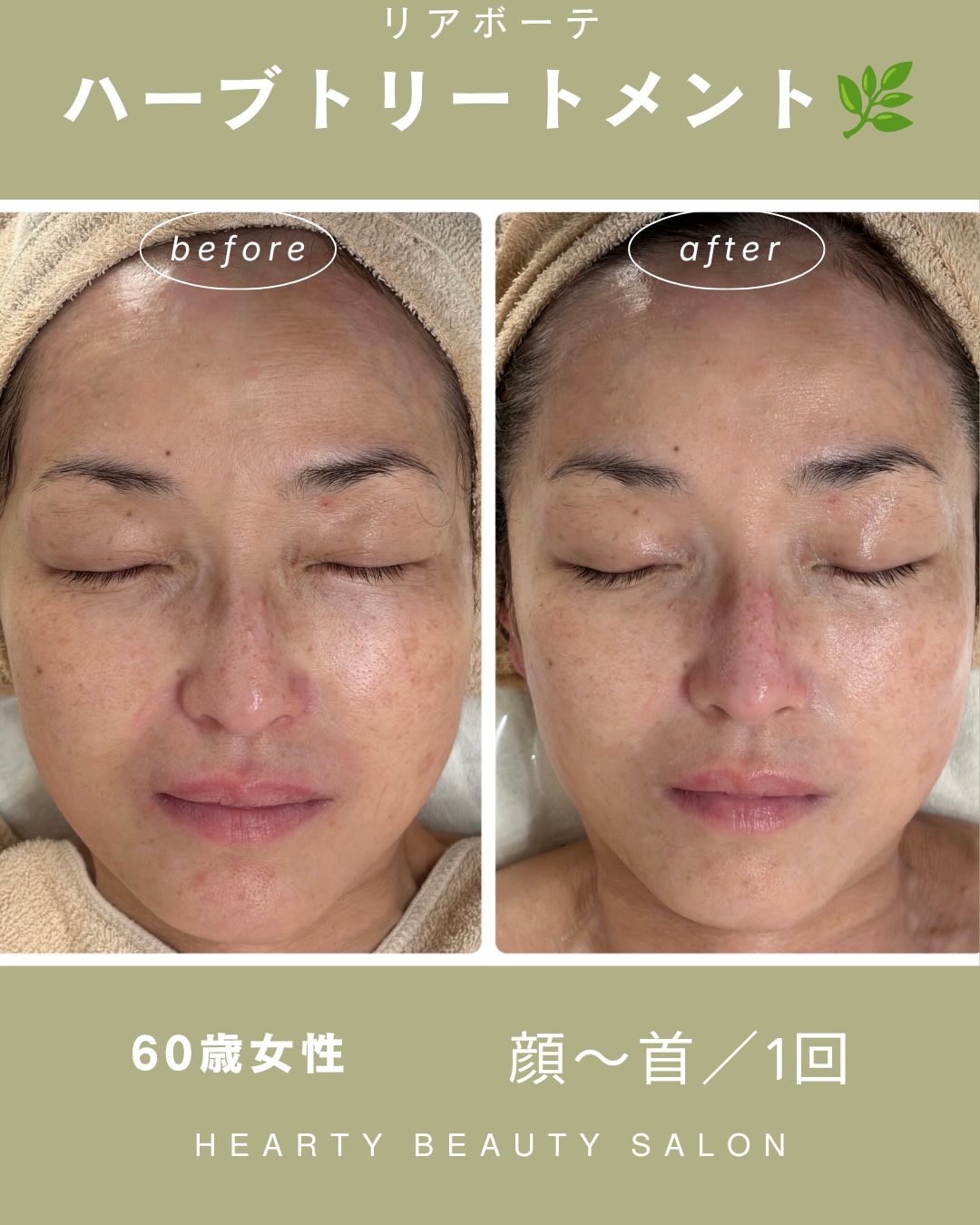 RE L'ABEAUTE（リアボーテ） 公式サイト 幹細胞サイエンスの最高峰の